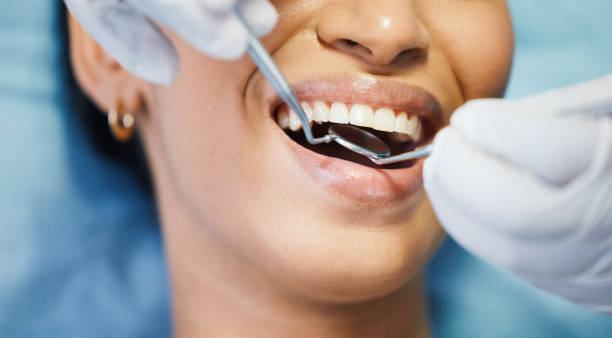 Best Dental Abscess Treatment in Des Moines, WA